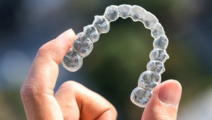 ClearCorrect aligner